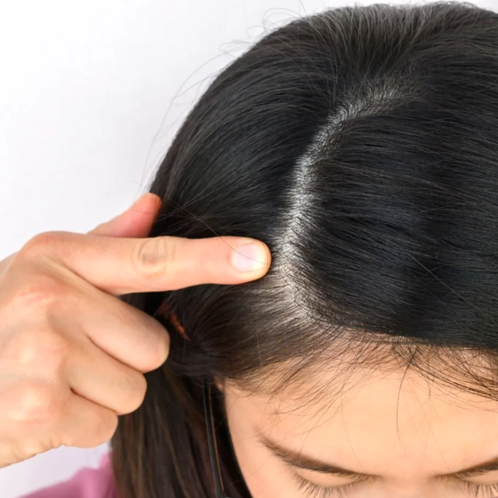 Scalp Treatment Hair Line by Retern Hair Growth